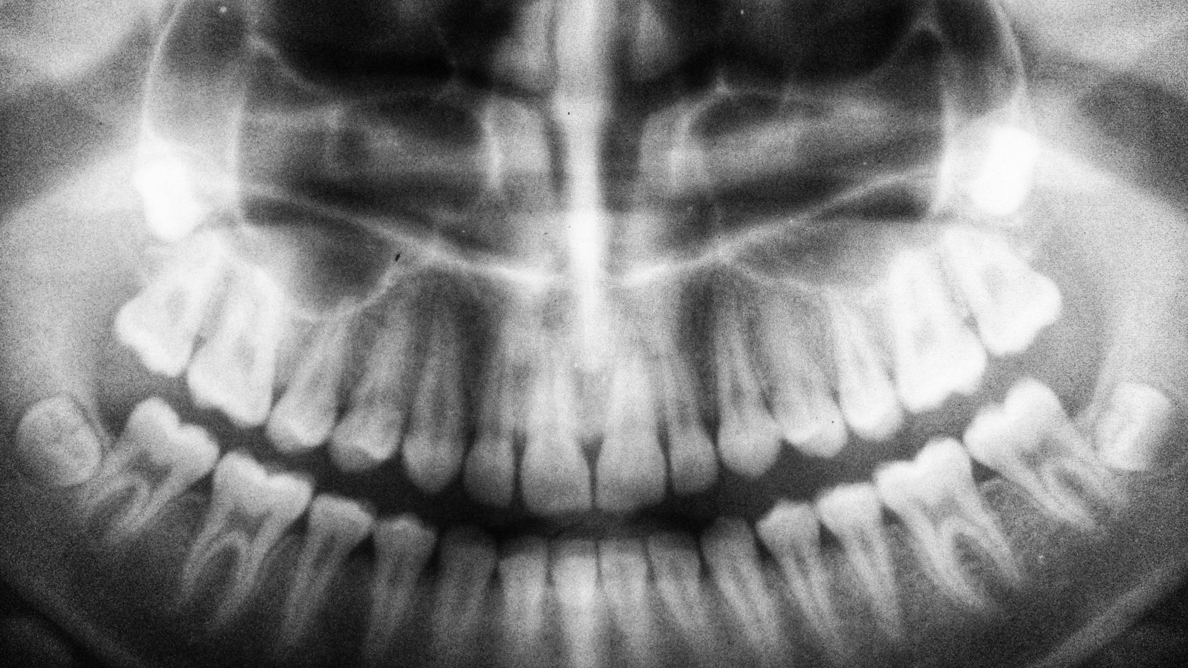 ブルーライトで照らされた歯のX線フィルム=歯科用CBCT・パノラマレントゲン等の検査・診断技術。クリニック選定で見るべき院内設備の現代性を象徴。